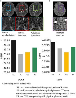 PIMA-CT: Physical Model-Aware Cyclic Simulation and Denoising for Ultra-Low-Dose CT Restoration